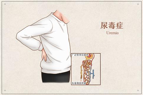 1661810144665701.jpg 攝圖網(wǎng)_401794004_banner_尿毒癥醫(yī)療插畫(非企業(yè)商用) (1).jpg