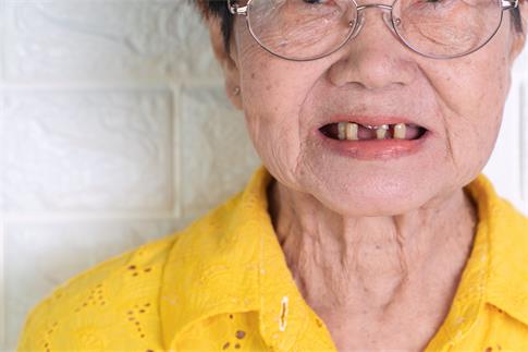 1682394210231459.jpg 攝圖網(wǎng)_308021423_70歲以上的亞洲老年婦女笑著微牙齒有幾顆斷裂的牙齒這里難以咀嚼老人的食物這里需要假牙來替代缺失的齒和幫助咀嚼食物這需要用假牙替換(企業(yè)商用).jpg